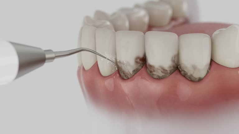 Reliable Dental Implants contractor in Portola, CA by Smile Center Dentistry